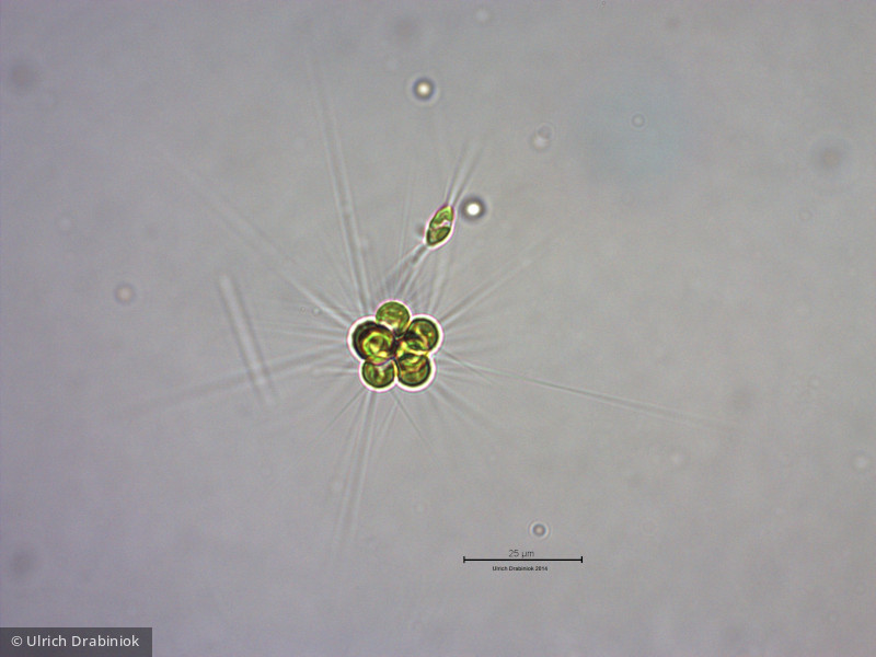 Chlorophyta Chlorophyceae Chlorococcales Micractinium pusillum