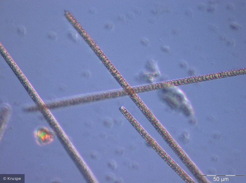 Planktothrix_rubescens_1260798140 - Cyanobacteria Cyanobacteria Oscillatoriales Planktothrix rubescens