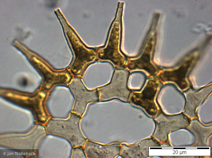 Pediastrum_simplex_1253273770 - Chlorophyta Chlorophyceae Chlorococcales Monactinus simplex