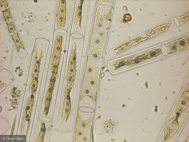 Chlorophyta Conjugatophyceae Zygnematales Mougeotia sp.