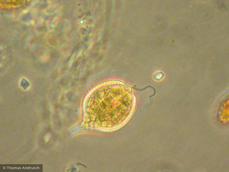 Euglenophyta Euglenophyceae Euglenales Phacus sp.
