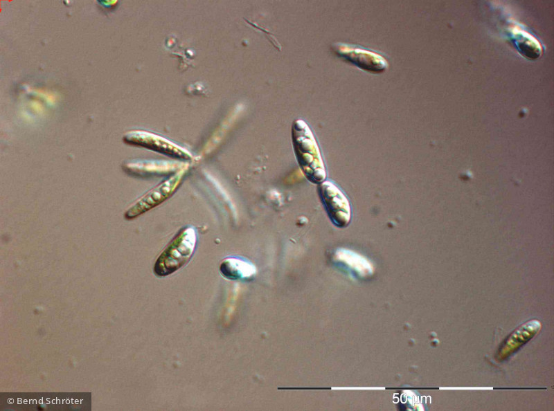 Pseudococcomyxa sp. · Chlorophyta Chlorophyceae Chlorococcales · 1000x