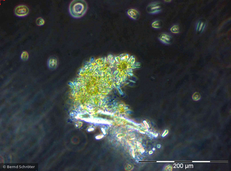 Pseudococcomyxa sp. · Chlorophyta Chlorophyceae Chlorococcales · 200x