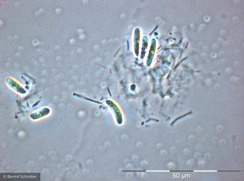 Pseudococcomyxa sp. · Chlorophyta Chlorophyceae Chlorococcales · 1000x