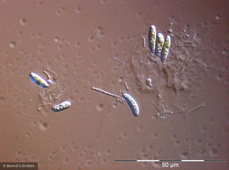 Pseudococcomyxa sp. · Chlorophyta Chlorophyceae Chlorococcales · 1000x