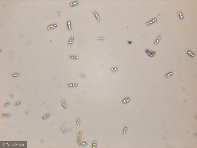 Pseudococcomyxa sp. · Chlorophyta Chlorophyceae Chlorococcales · 400x