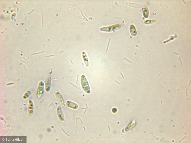 Pseudococcomyxa sp. · Chlorophyta Chlorophyceae Chlorococcales · 400x