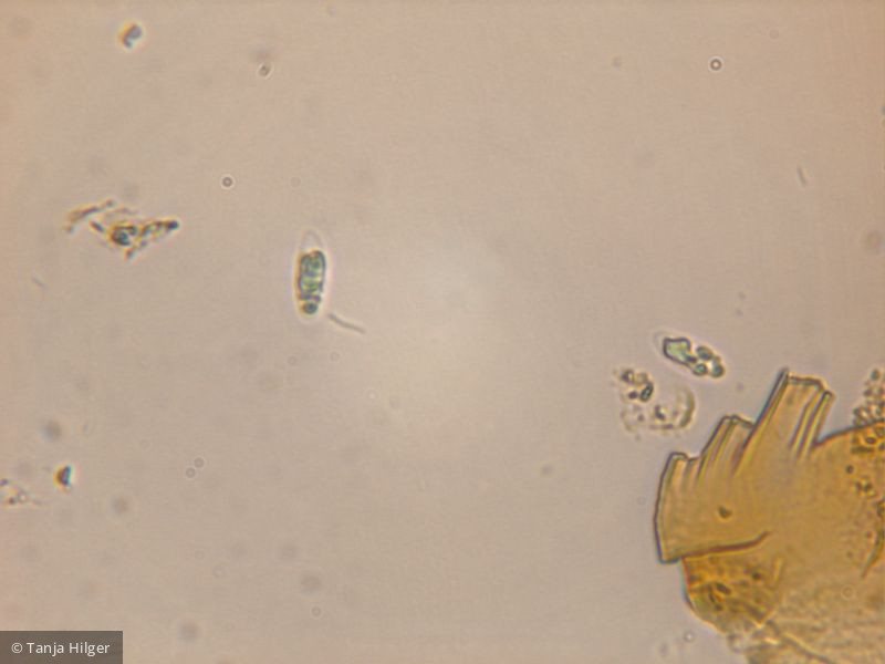 Pseudococcomyxa sp. · Chlorophyta Chlorophyceae Chlorococcales · 400x