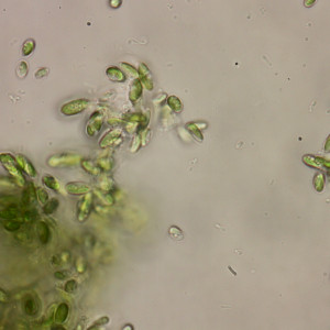 Pseudococcomyxa sp.