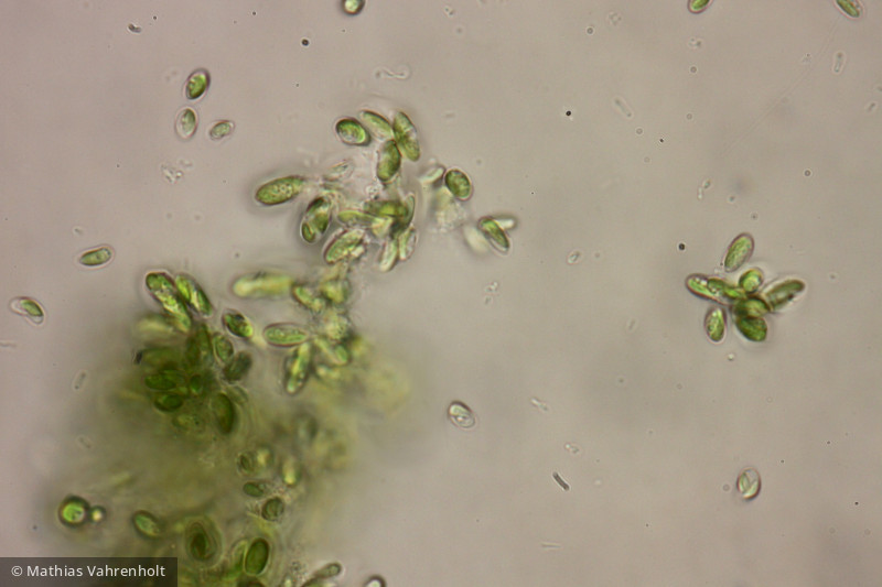 Pseudococcomyxa sp. · Chlorophyta Chlorophyceae Chlorococcales · 1000x