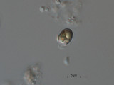 Pseudokephyrion_sp._1260526429