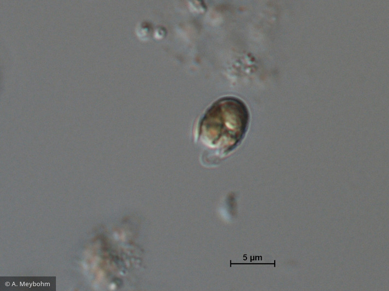 Pseudokephyrion_sp._1260526429 - Heterocontophyta Chrysophyceae Chromulinales Pseudokephyrion sp.
