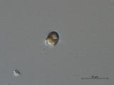 Pseudokephyrion_sp._1260526570
