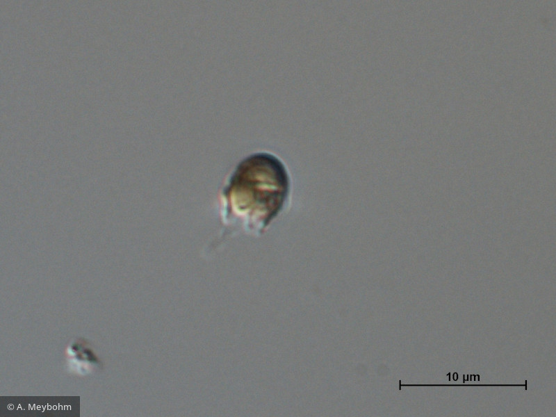 Pseudokephyrion_sp._1260526570 - Heterocontophyta Chrysophyceae Chromulinales Pseudokephyrion sp.