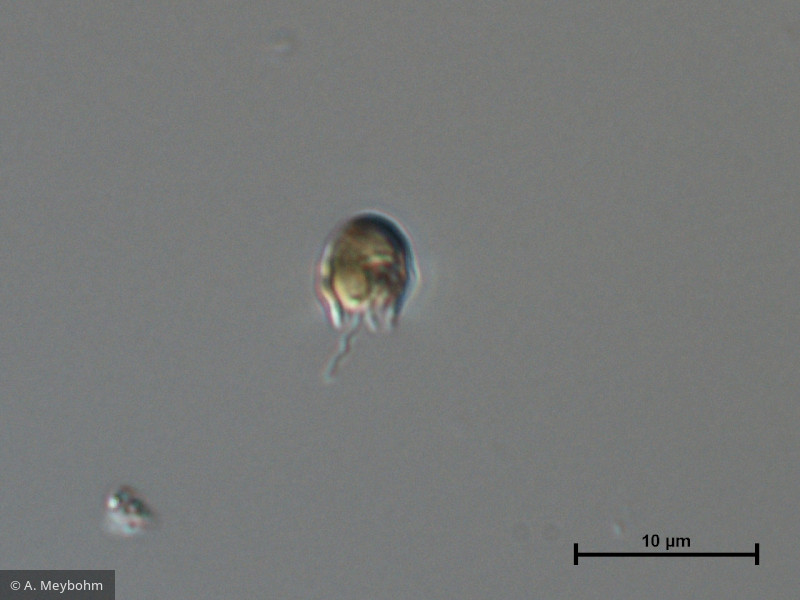 Pseudokephyrion_sp._1260526672 - Heterocontophyta Chrysophyceae Chromulinales Pseudokephyrion sp.