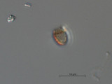 Pseudokephyrion_sp._1260526769