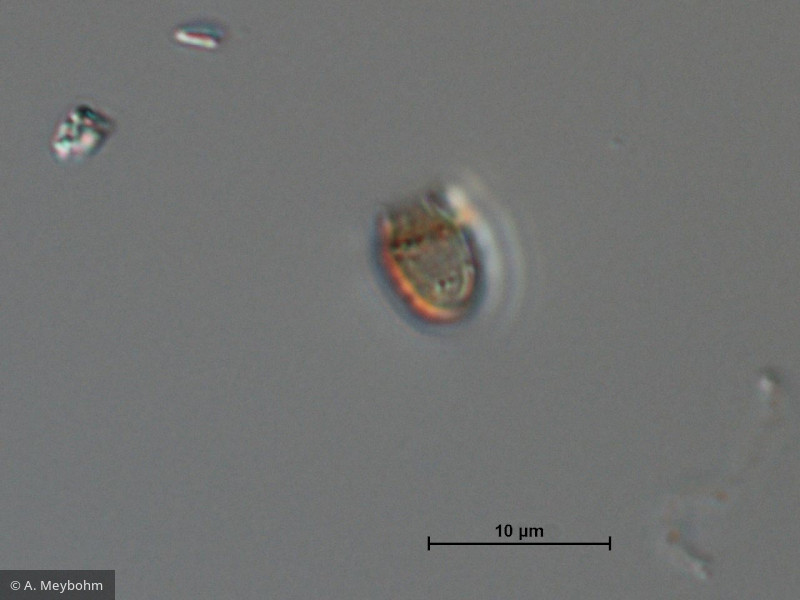 Pseudokephyrion_sp._1260526769 - Heterocontophyta Chrysophyceae Chromulinales Pseudokephyrion sp.