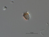 Pseudokephyrion_sp._1260526850