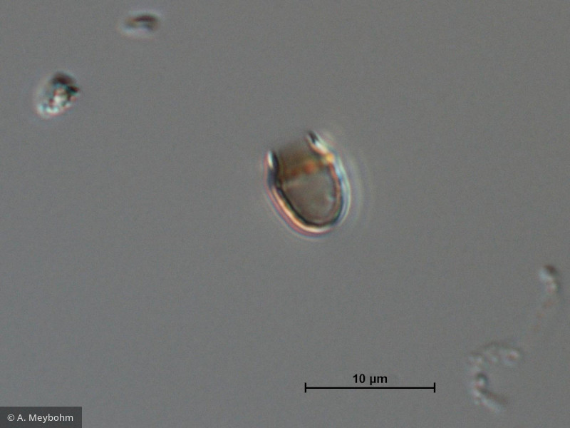 Pseudokephyrion_sp._1260526850 - Heterocontophyta Chrysophyceae Chromulinales Pseudokephyrion sp.