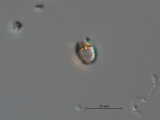 Pseudokephyrion_sp._1260526993