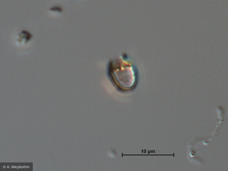 Pseudokephyrion_sp._1260526993 - Heterocontophyta Chrysophyceae Chromulinales Pseudokephyrion sp.