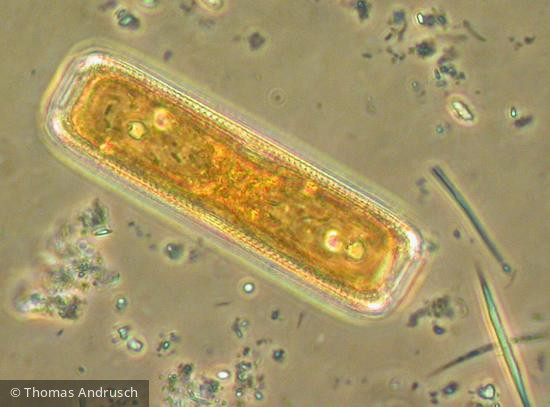 Pinnularia_spec_1271448067 - Heterocontophyta Bacillariophyceae Pennales Pinnularia sp.