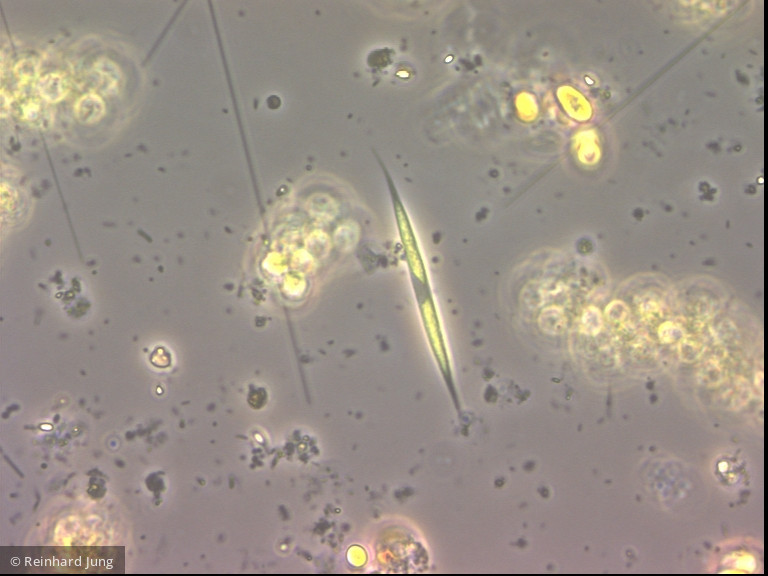 Monoraphidium tortile · Chlorophyta Chlorophyceae Chlorococcales