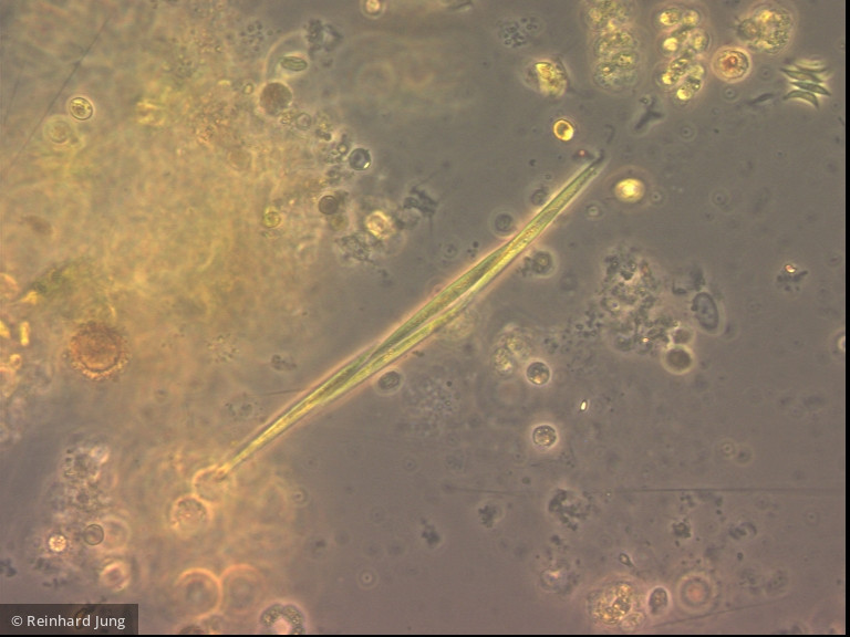 Monoraphidium tortile · Chlorophyta Chlorophyceae Chlorococcales