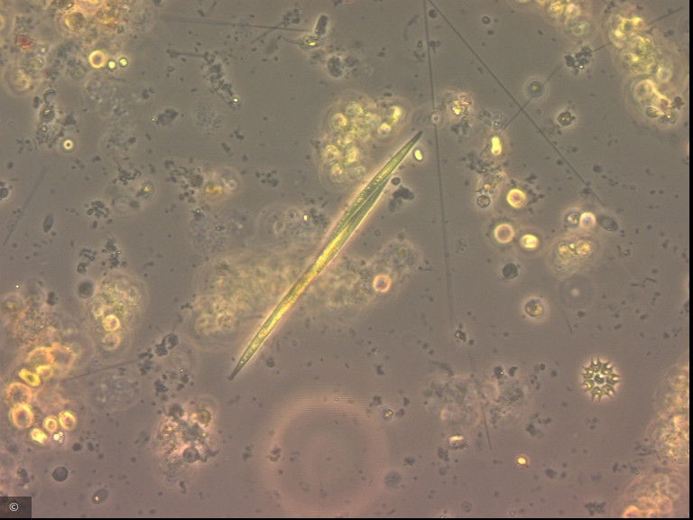 Monoraphidium tortile · Chlorophyta Chlorophyceae Chlorococcales