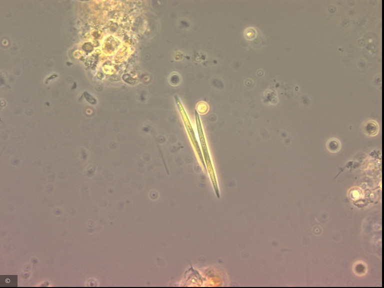 Monoraphidium tortile · Chlorophyta Chlorophyceae Chlorococcales