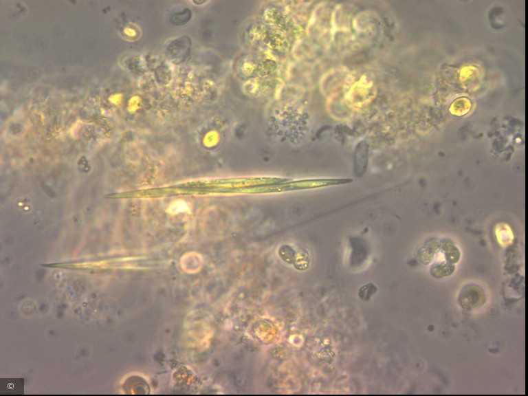 Monoraphidium tortile · Chlorophyta Chlorophyceae Chlorococcales