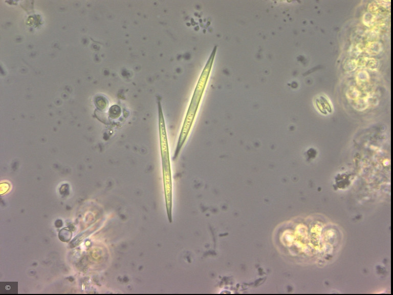 Monoraphidium tortile · Chlorophyta Chlorophyceae Chlorococcales