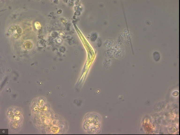 Monoraphidium tortile · Chlorophyta Chlorophyceae Chlorococcales