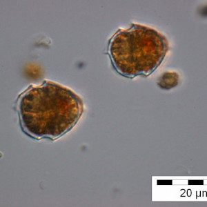 Peridinium_umbonatum_1255347446