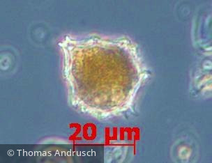 Dinophyta Dinophyceae Peridiniales Parvodinium umbonatum