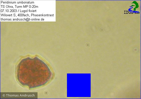 Peridinium_umbonatum_1238684930 - Dinophyta Dinophyceae Peridiniales Parvodinium umbonatum