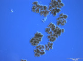 Microcystis_viridis_1236687465
