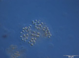 Microcystis_viridis_1251708479