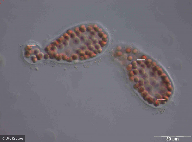 Microcystis_wesenbergii_1236682453 - Cyanobacteria Cyanobacteria Chroococcales Microcystis wesenbergii