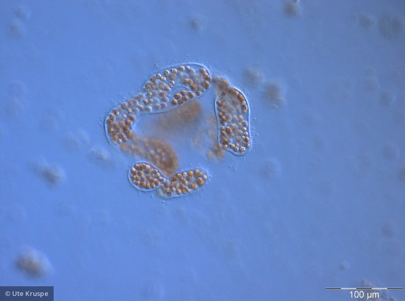 Microcystis_wesenbergii_1236686315 - Cyanobacteria Cyanobacteria Chroococcales Microcystis wesenbergii