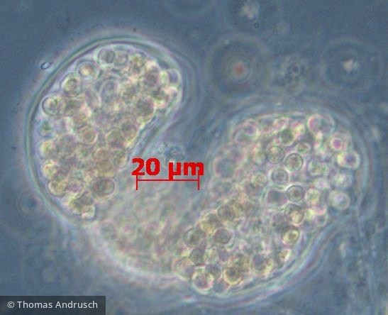 Cyanobacteria Cyanobacteria Chroococcales Microcystis wesenbergii
