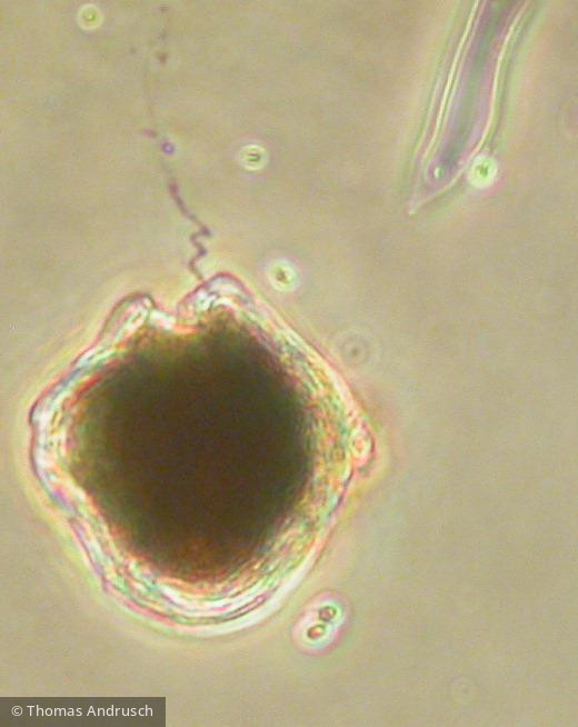 Peridinium_willei_1271450570 - Dinophyta Dinophyceae Peridiniales Peridinium willei