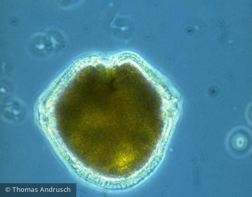Peridinium_willei_1271452620 - Dinophyta Dinophyceae Peridiniales Peridinium willei