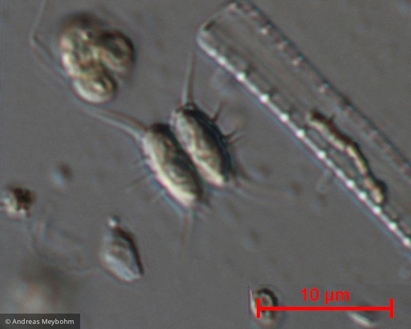 Scenedesmus_sempervirens_1276509418 - Chlorophyta Chlorophyceae Chlorococcales Desmodesmus abundans