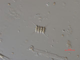 Scenedesmus_sempervirens_1276509924