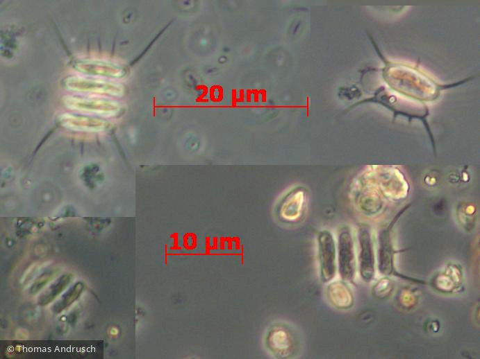 Chlorophyta Chlorophyceae Chlorococcales Desmodesmus abundans