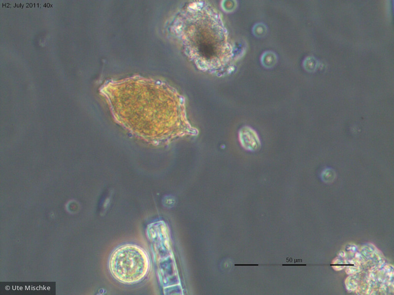 Euglenophyta Euglenophyceae Euglenales Strombomonas acuminata