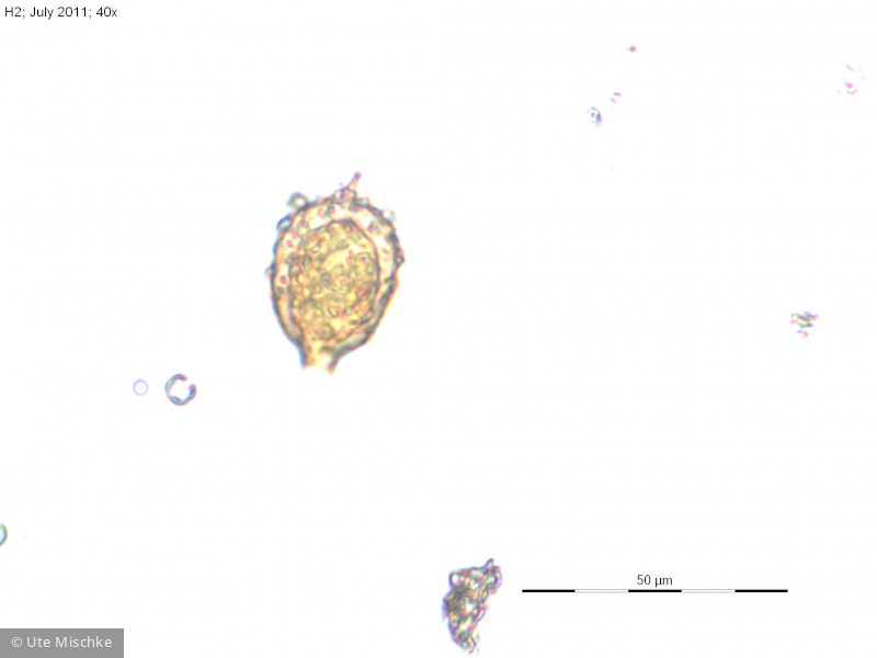 Euglenophyta Euglenophyceae Euglenales Strombomonas acuminata