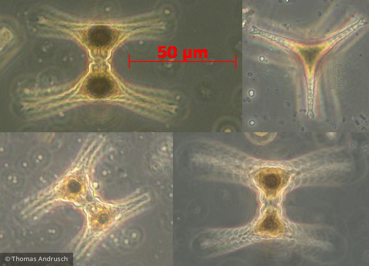 Chlorophyta Conjugatophyceae Desmidiales Staurastrum anatinum