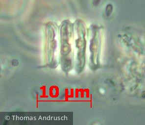 Chlorophyta Chlorophyceae Chlorococcales Scenedesmus caudato-aculeolatus